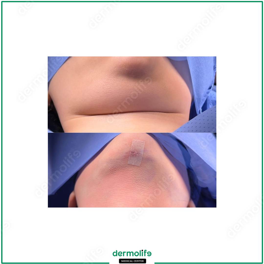 rimodellamento del mento clinica estetica italy 