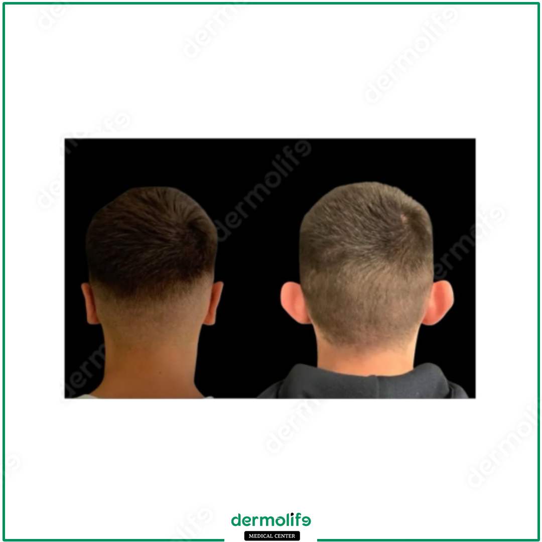 otoplastica clinica estetica italy 