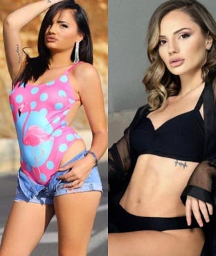 liposuction