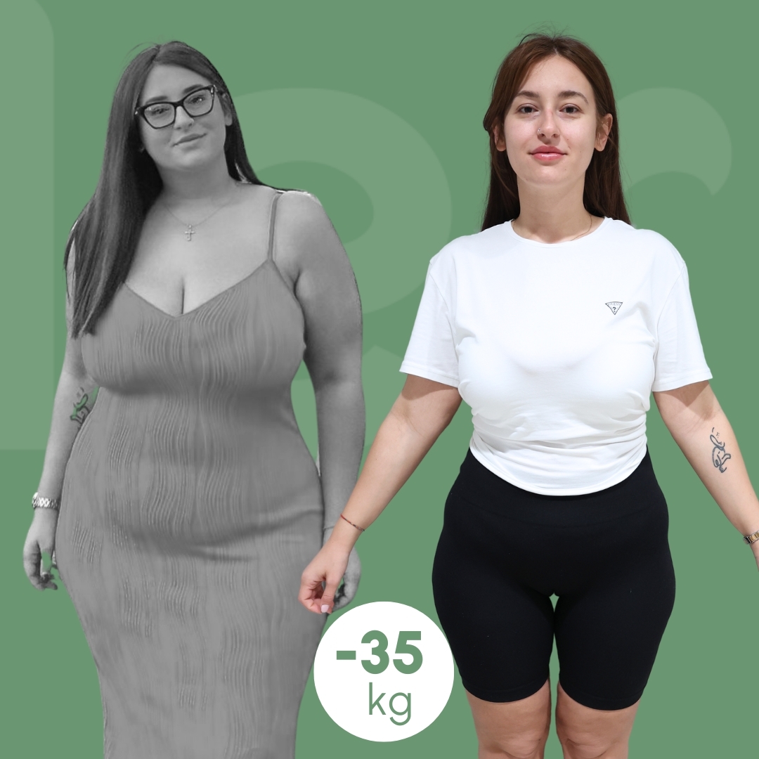 palloncino-gastrico clinica estetica italy 