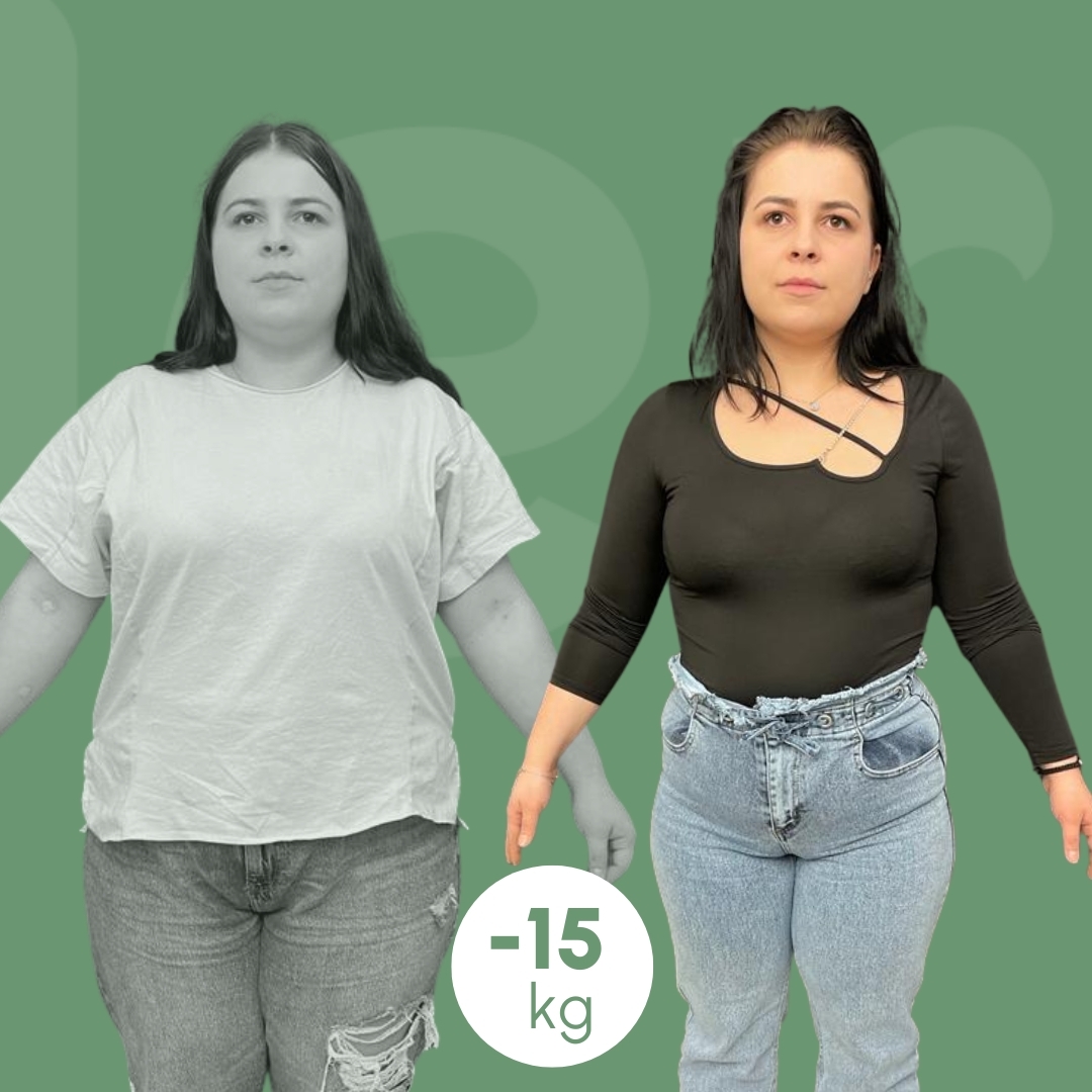 palloncino-gastrico clinica estetica italy 