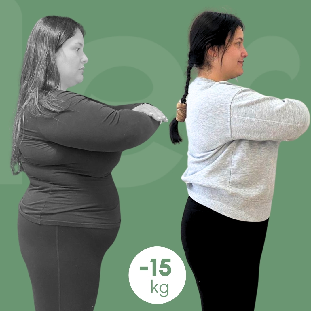 palloncino-gastrico clinica estetica italy 