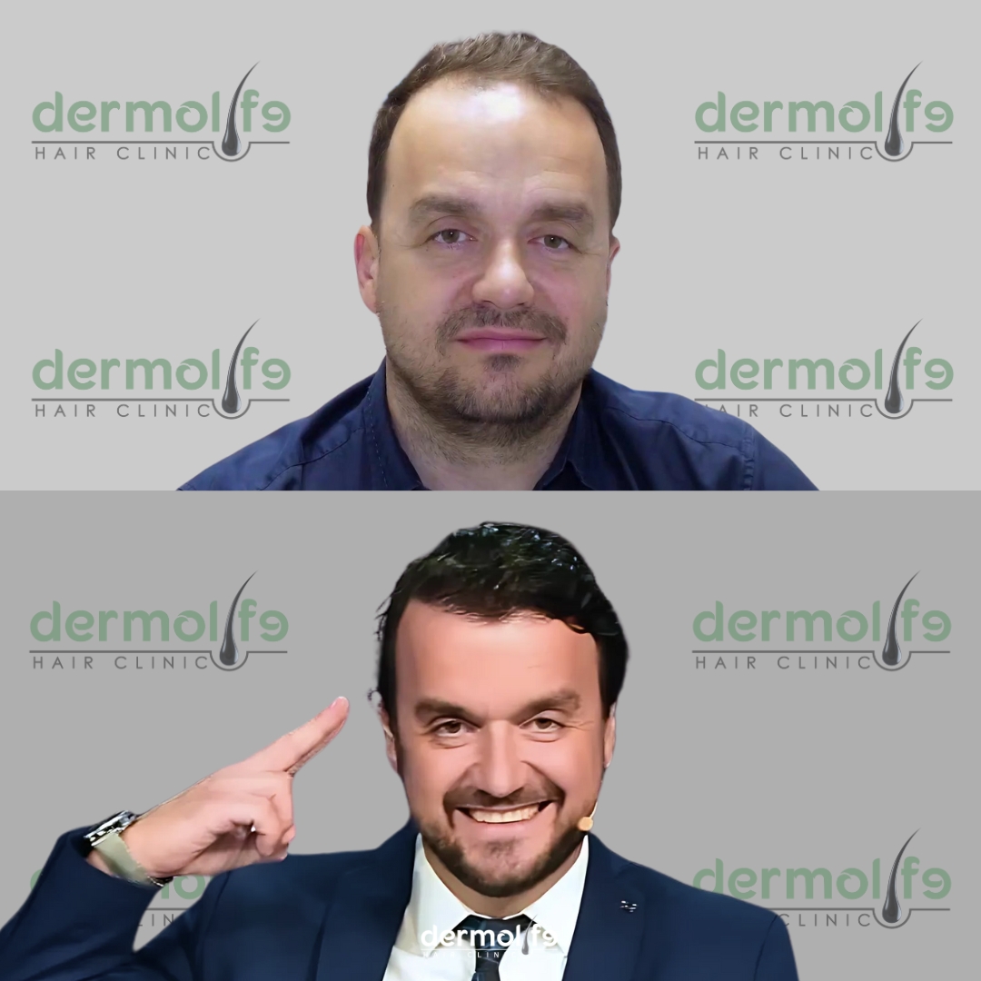 capelli clinica estetica italy 