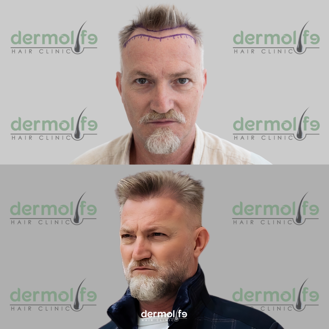 capelli clinica estetica italy 