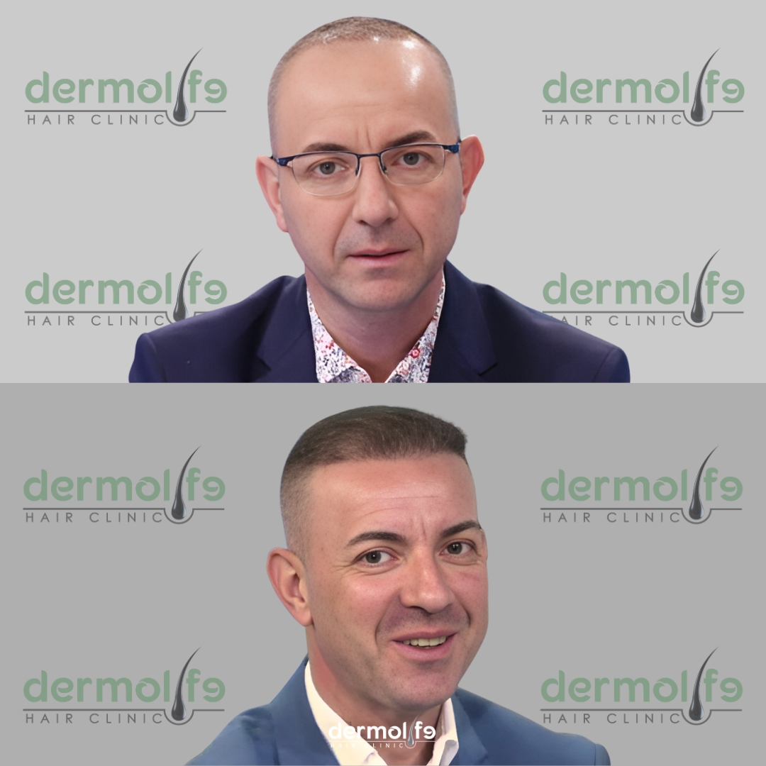 capelli clinica estetica italy 