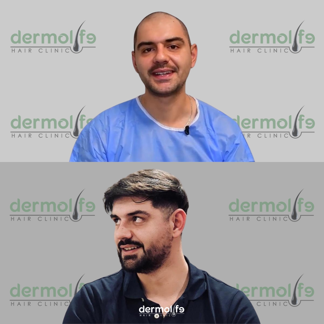 capelli clinica estetica italy 