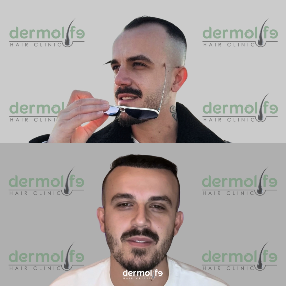 capelli clinica estetica italy 