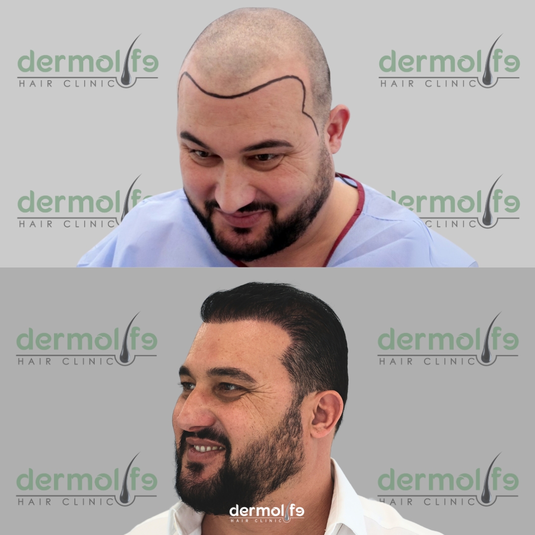 capelli clinica estetica italy 