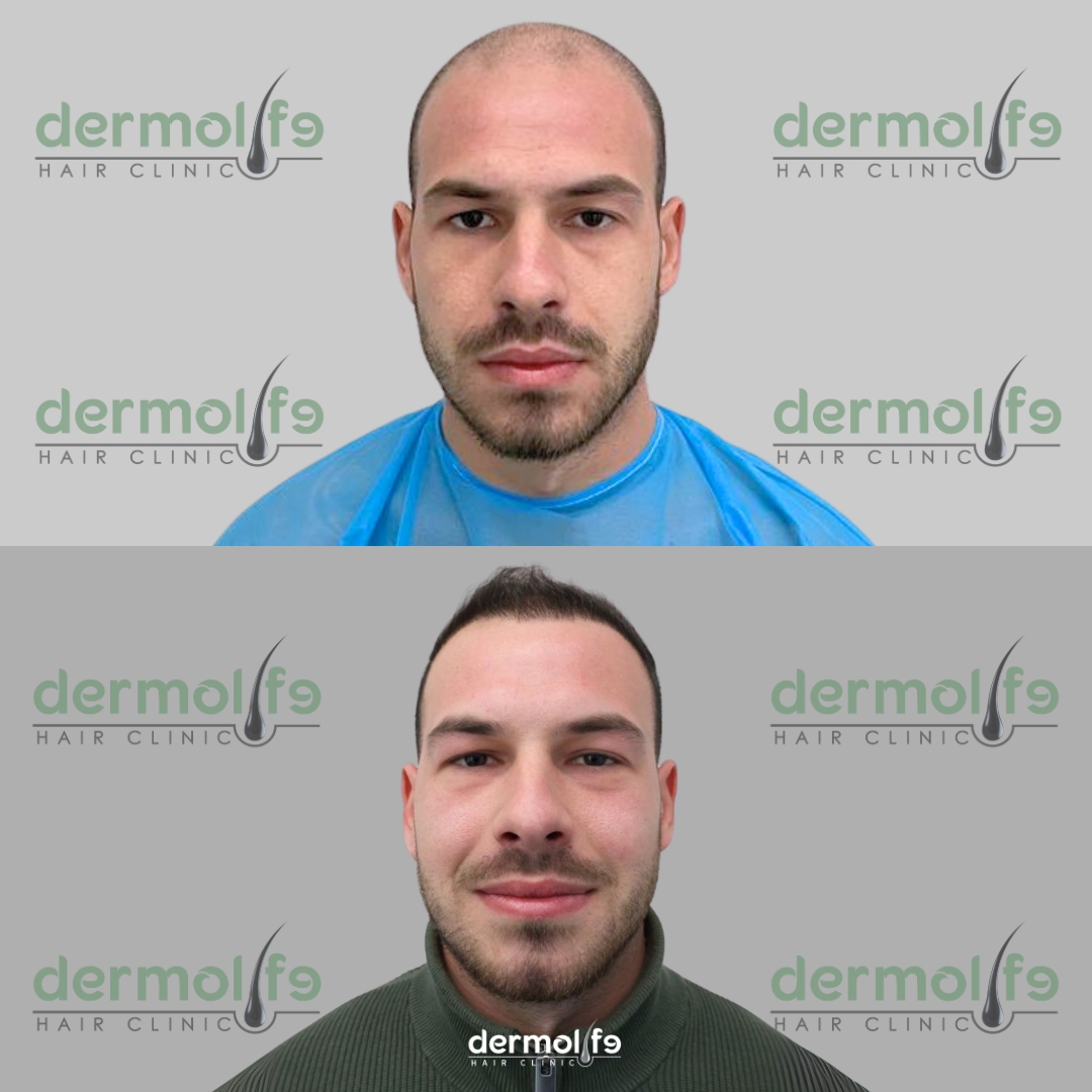 capelli clinica estetica italy 