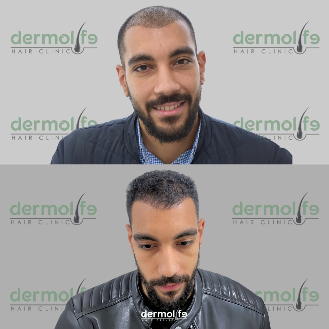 capelli clinica estetica italy 