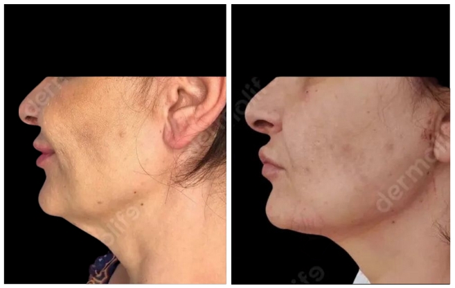 facelift aesthetic clinic italy 