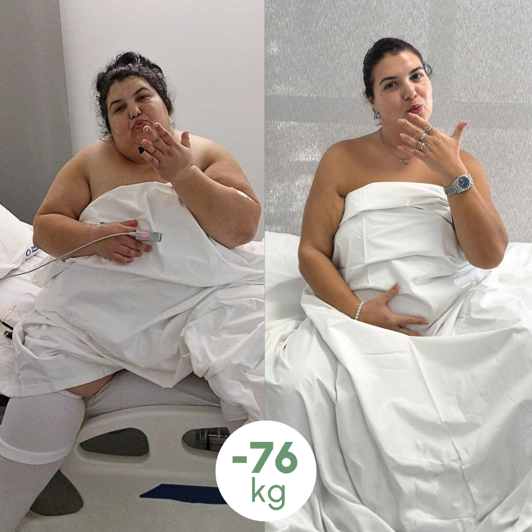 sleeve clinica estetica italy 