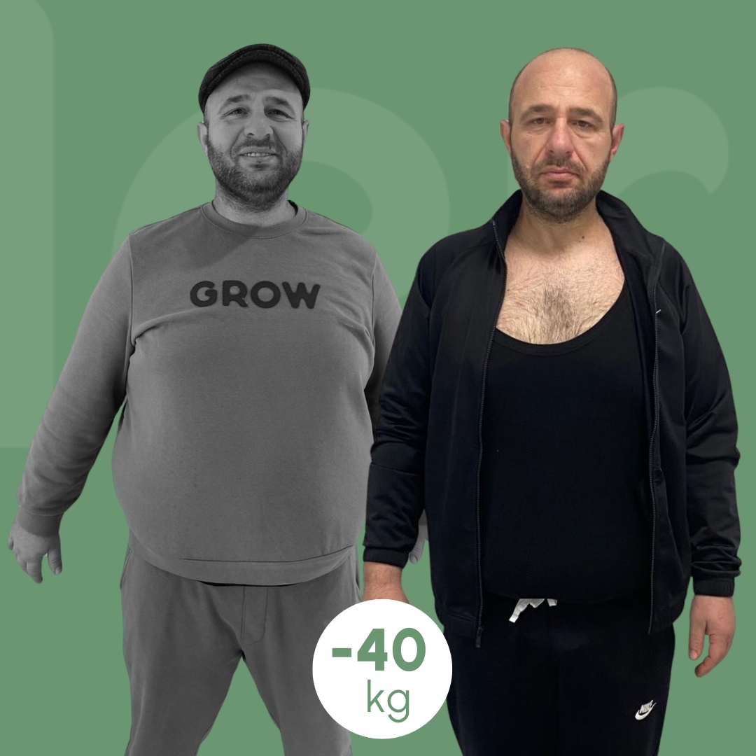 sleeve clinica estetica italy 