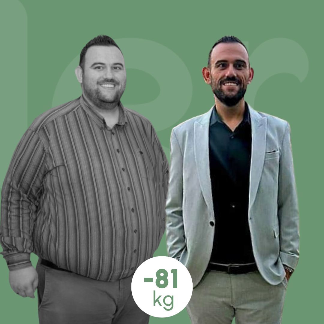 sleeve clinica estetica italy 