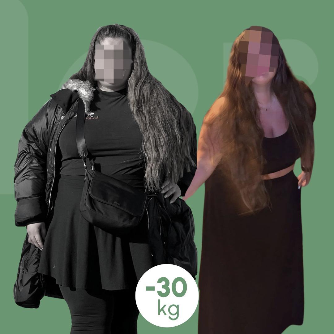 sleeve clinica estetica italy 