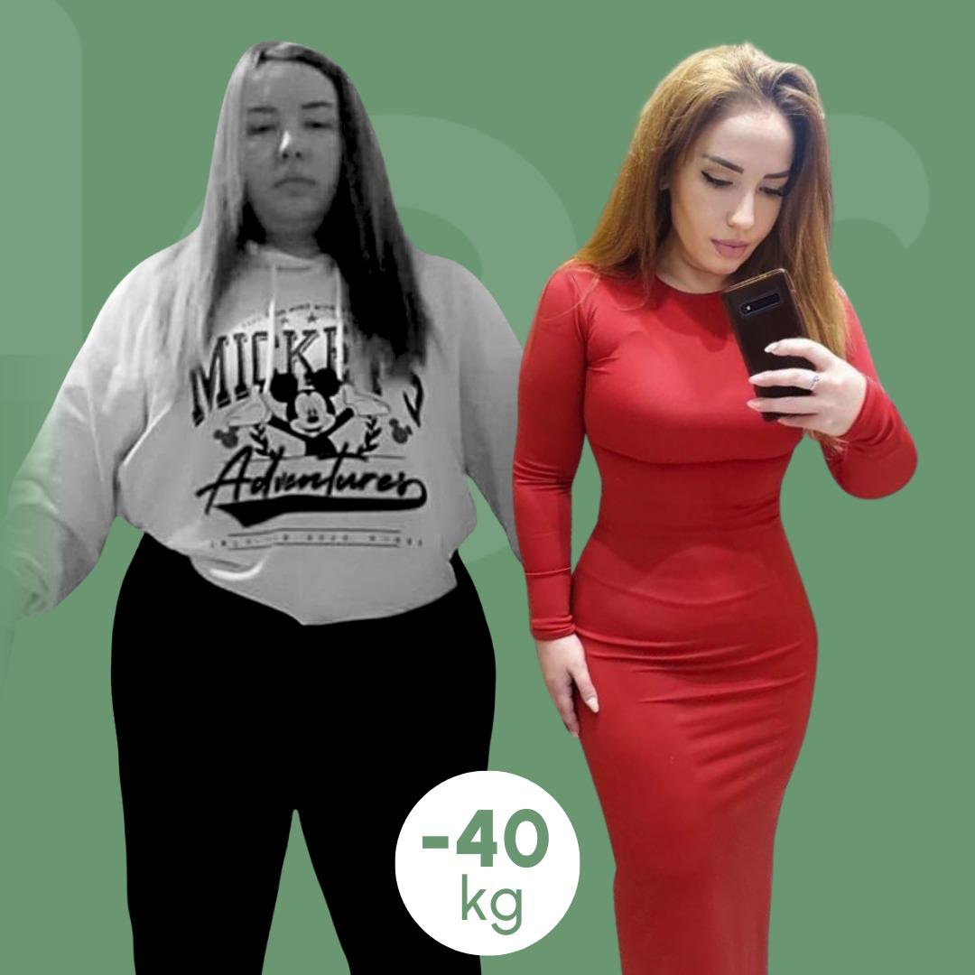 sleeve clinica estetica italy 